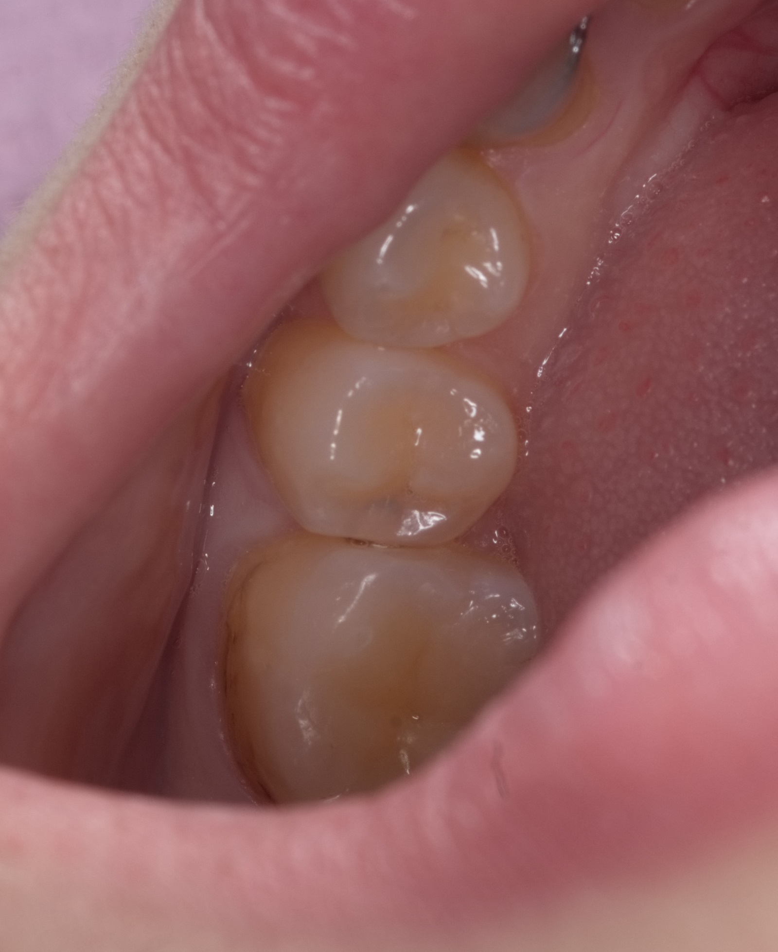 Фото клиники Smile Центр